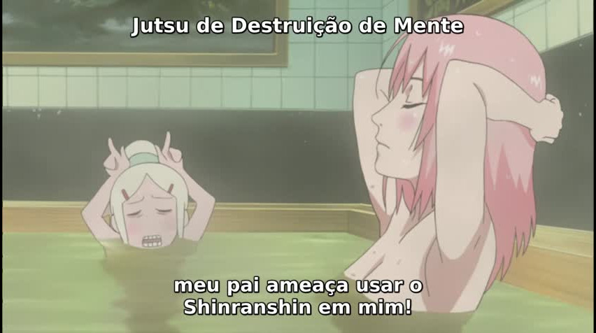 Episódio 311